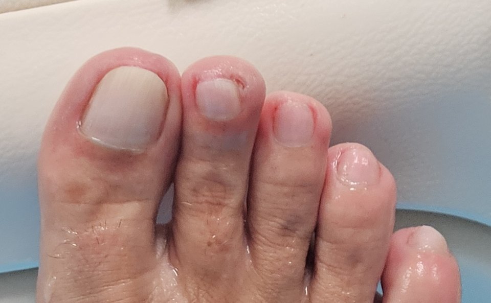 Close-up of polished nails and a hand massage